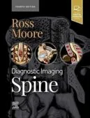 Trang chủ 7 Diagnostic Imaging Spine