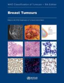 WHO Classification Of Breast Tumours WHO Classification Of Tumours Volume 2